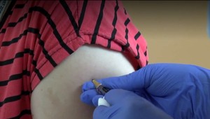 Na východe bojujú s osýpkami. Epidémia stále nie je pod kontrolou