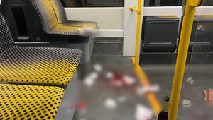 Zastal sa obťažovaných žien a takmer pri tom zomrel. Mladíka brutálne napadol muž s nožom