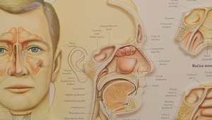 Dusivá jar pre alergikov: Odborníci varujú pred dlhšou a silnejšou sezónou