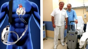 Prvý slovenský pacient s umelým srdcom je už aj po transplantácii srdca