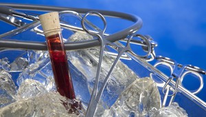 Významný objav! Vedci skúmajú 3200 rokov starú kostru s rakovinou