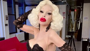 Kedysi pohľadný muž, dnes umelohmotná kreatúra. TOTO je majiteľka najdrahšieho tela