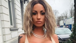 Od puberty túžila po veľkých prsiach, dočkala sa: TAKTO vyzerá jej hrudník po štyroch zákrokoch