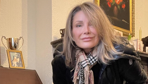 Nina chcela novú tvár, aby vyzerala mladšie: Toto jej dokázali urobiť na tureckej klinike