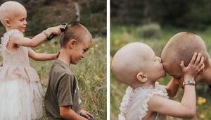 Silné FOTO malej bojovníčky obletelo svet: Pohľad na Lulu dnes, vás chytí za srdce