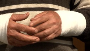 Pes ušiel z voliéry. Rozzúrený napadol staršieho pána