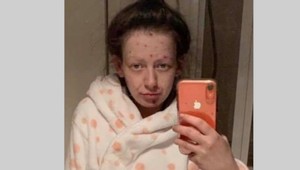 Šokujúce FOTO matky závislej od drog je len pre silné žalúdky: 4 mesiace je čistá a nespoznali by ste ju!