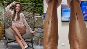 FOTO: Zora Czoborová ukázala, ako vyzerali jej NOHY pred operáciou: TOTO chcelo veľa odvahy!