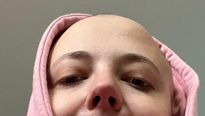 Trpké priznanie a fotka Slováčkovej po liečbe! Ukázať sa TAKTO chce odvahu!