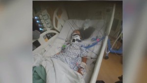 Cesta do škôlky sa skončila hrôzou: Dievča do hlavy trafila letiaca fľaša