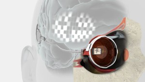 Nevidiacim svitá nádej. Vynašli prototyp bionického oka