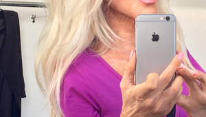 Dana ukázala svoje telo po tom, ako zaživa horela: Jej FOTO sú len pre silné žalúdky