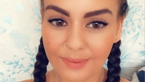 Žena zatúžila po novom chrupe: Teraz svoje ústa nedokáže zatvoriť!