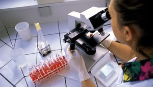 Červené krvinky v prášku. Vedci vytvorili umelú krv