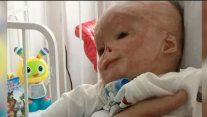 Popálené bábätko pre jeho vzhľad opustila vlastná mama: Má už 7 rokov a TOTO sa s ním stalo!