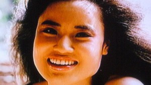 Krásna modelka sa zmenila na monštrum: Do tváre si pichala olej na vyprážanie