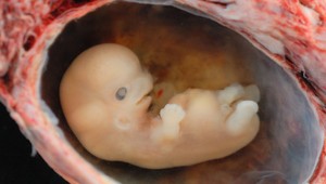 V Tennessee sa narodilo bábätko z 24 rokov zmrazeného embrya