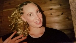 Cítila sa ako škaredé káčatko, prepadla plastikám: Po 14-tich zákrokoch by ste ju nespoznali