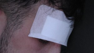 Partia mužov napadla mladého futbalistu: Po útoku má v hlave dve titánové dlahy