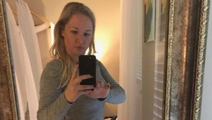 Podstúpila 9 plastík, aby sa podobala na prezidentovu dcéru: Aha, ako vyzerá!