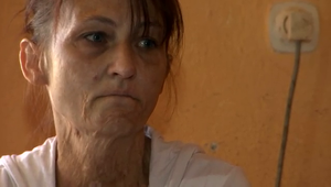 Nechcela mať so svokrom pomer, on sa jej za to pomstil: Polial ju benzínom a zapálil!