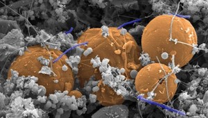 Pod našimi nohami žijú zombie baktérie