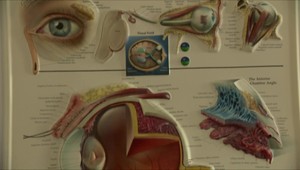 Vidíte rozmazane do blízka aj do diaľky? Možno máte toto ochorenie rohovky