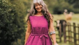 Keď prišla o nohu, hanbila sa za svoj hendikep: Z Nancy je dnes zrelá modelka, o ktorú sa bijú svetové značky