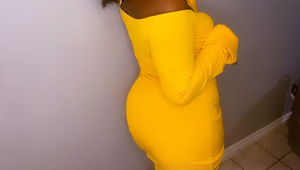 12 rokov TO skrýva, aby sa jej ľudia nesmiali: Videli ste ženu, ktorá mení farbu?