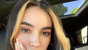 Keď manžel uvidel jej zväčšené pery, takmer mu oči vypadli: Pozrite sa na TO!