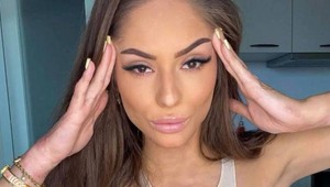 TOTO chcelo poriadnu odvahu! Popálená Týnuš odhalila svoju tvár bez štipky mejkapu