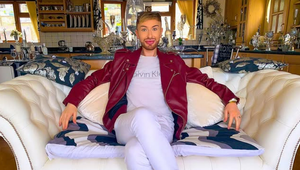 Roky bol závislý na botoxe a výplniach: Teraz si ich dal rozpustiť a vyzerá ako iný človek!