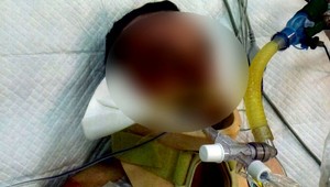 Muž po páde na bicykli skončil v nemocnici. Polícia pátrala po jeho totožnosti