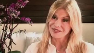 Táto žena má najviac plastík