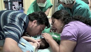 Siamské dvojčatko z Čile zomrelo, zlyhalo mu srdce