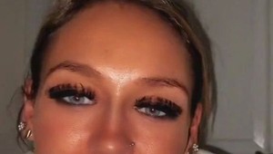 Po rokoch si splnila sen a nechala si urobiť nové zuby: Keď sa uvidela v zrkadle, rozplakala sa