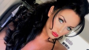 Takto dopadla žena závislá na plastikách: Za vylepšenia minula už 120-tisíc eur!