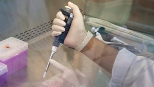 Poplach v pezinskej nemocnici: Pacientke po opakovanom testovaní potvrdili koronavírus