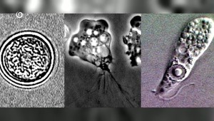 Hygienici preverujú kúpaliská po úmrtí 11-ročného chlapca