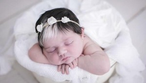 FOTO bábätka s dvojfarebnými vlasmi obletelo svet: AHA, aké ich má dnes!