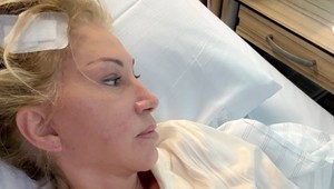 Carmen Geiss po operácii MOZGU: V hlave má 5 skrutiek a platničku! NEUVERÍTE, čo odkázala hejterom