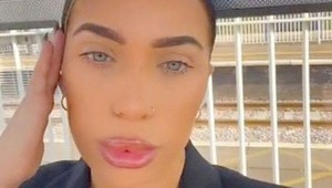 Po rokoch trápenia má konečne nové zuby, no ľudia sa jej smejú: Vyzeráš ako kôň!