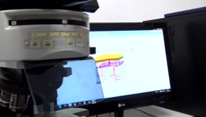 Veľký objav v liečbe ochorenia, ktoré postihuje mozog a miechu. Podarilo sa to aj vďaka Slovákom