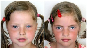 Anitku (9) a Sabinku (7) hľadali stovky ľudí. Pozrite si rozhovor s ich otcom