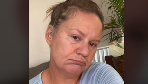 Keď TOTO urobí s ovisnutou kožou na tvári, omladne o 10 rokov: Wau, veď to je bomba!