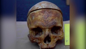 Mladý muž ukrýval vo svojej izbe ľudské lebky