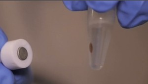 Nový test odhalí, či o 20 rokov dostanete Alzheimerovu chorobu