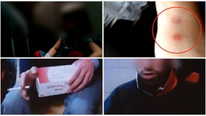 Prípad Jarky (7), ktorú otec pálil cigaretami, rieši aj šéf polície