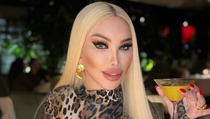 Lifting za 17 000 eur mal Jessicu Alves omladiť o desať rokov: Takto TO nakoniec dopadlo!