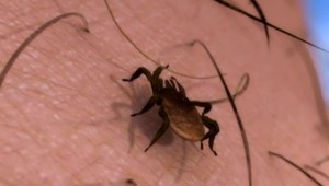 Invázia kliešťov na Kysuciach: V čadčianskej nemocnici ležia pacienti s boreliózou